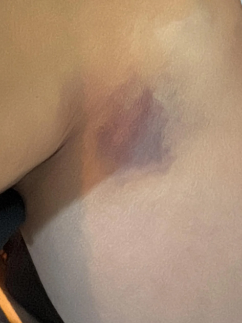 Yıldız Asyalı’dan Eşi Hakkında Şiddet Iddiası Kocam Tarafından Darp Edildim 1