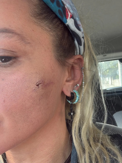 Yıldız Asyalı’dan Eşi Hakkında Şiddet Iddiası Kocam Tarafından Darp Edildim