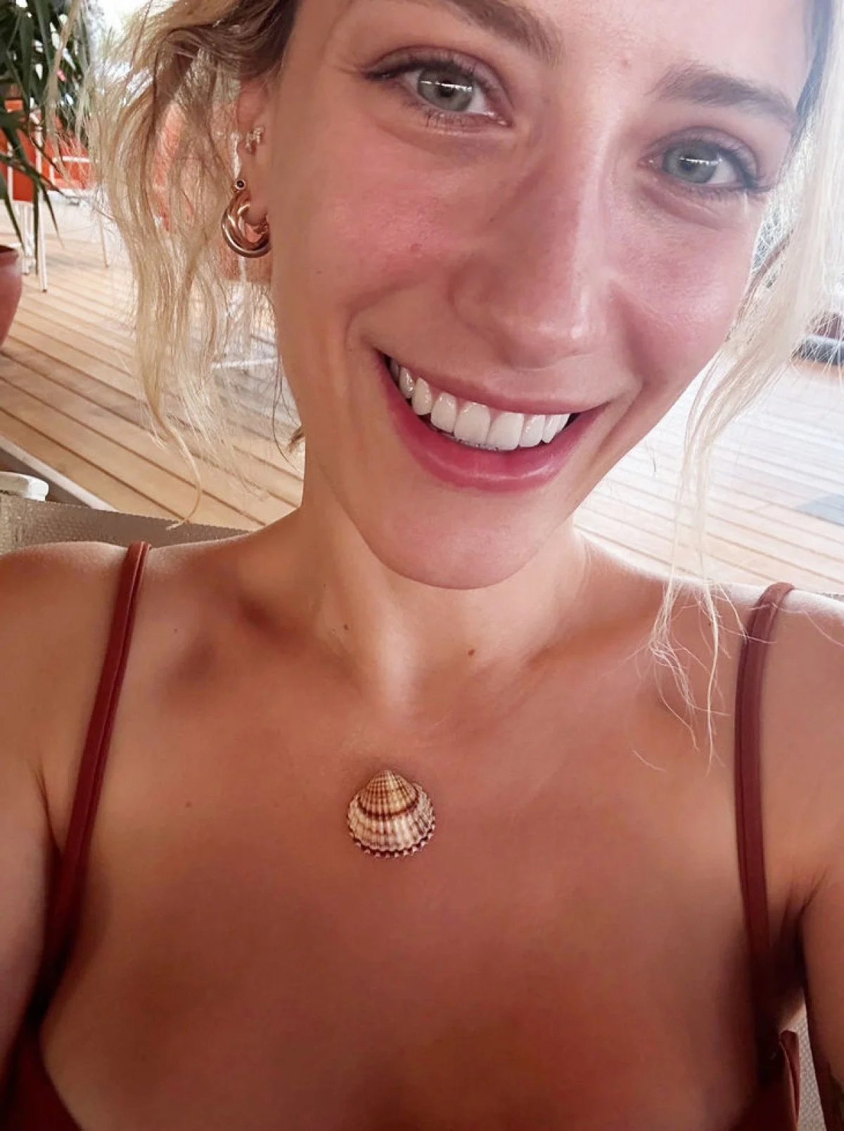 Hazal Kaya Dişlerini Yaptırdı