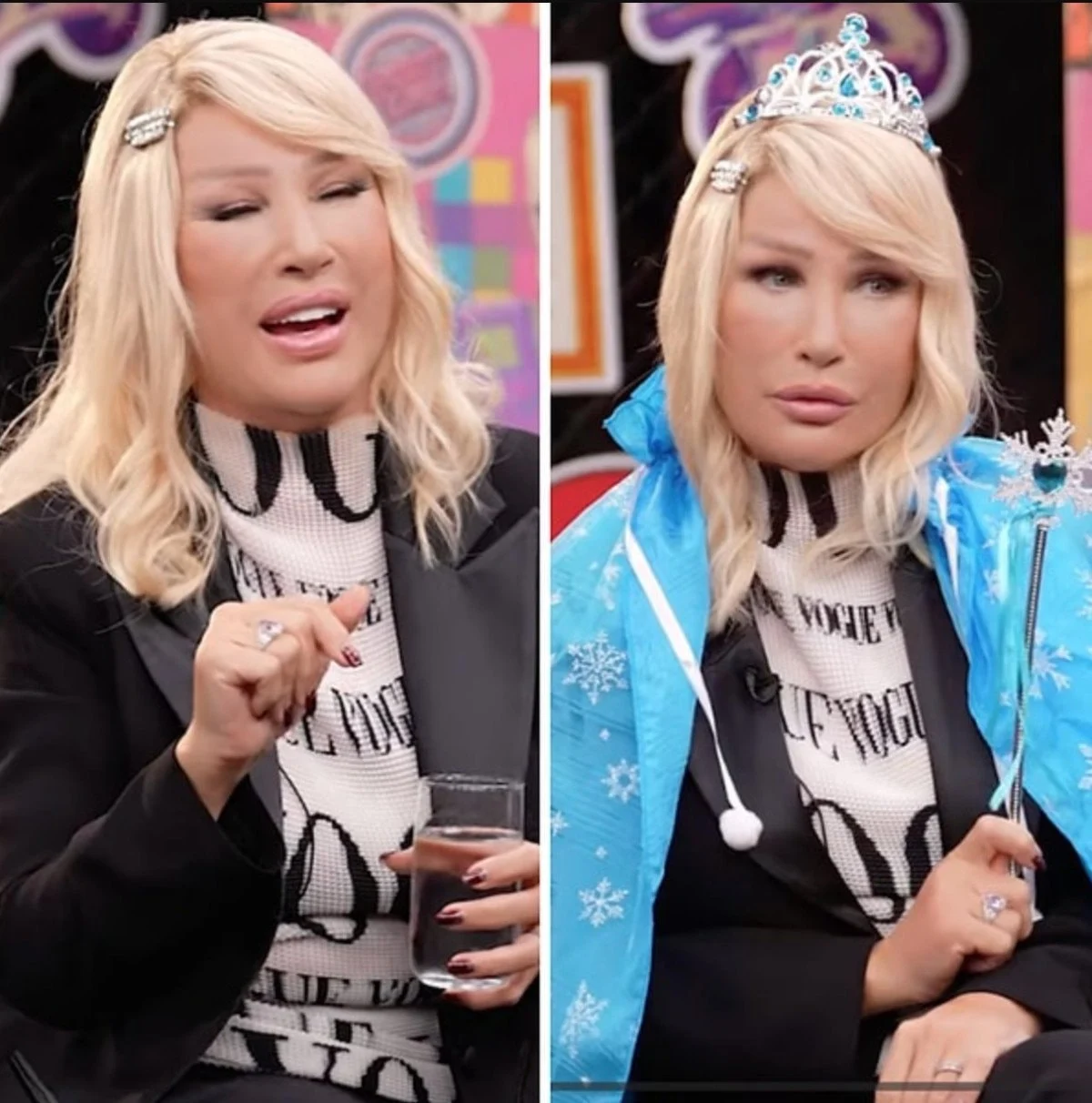 Seda Sayan’ın Yüzündeki Şişliğin Nedeni Belli Oldu1