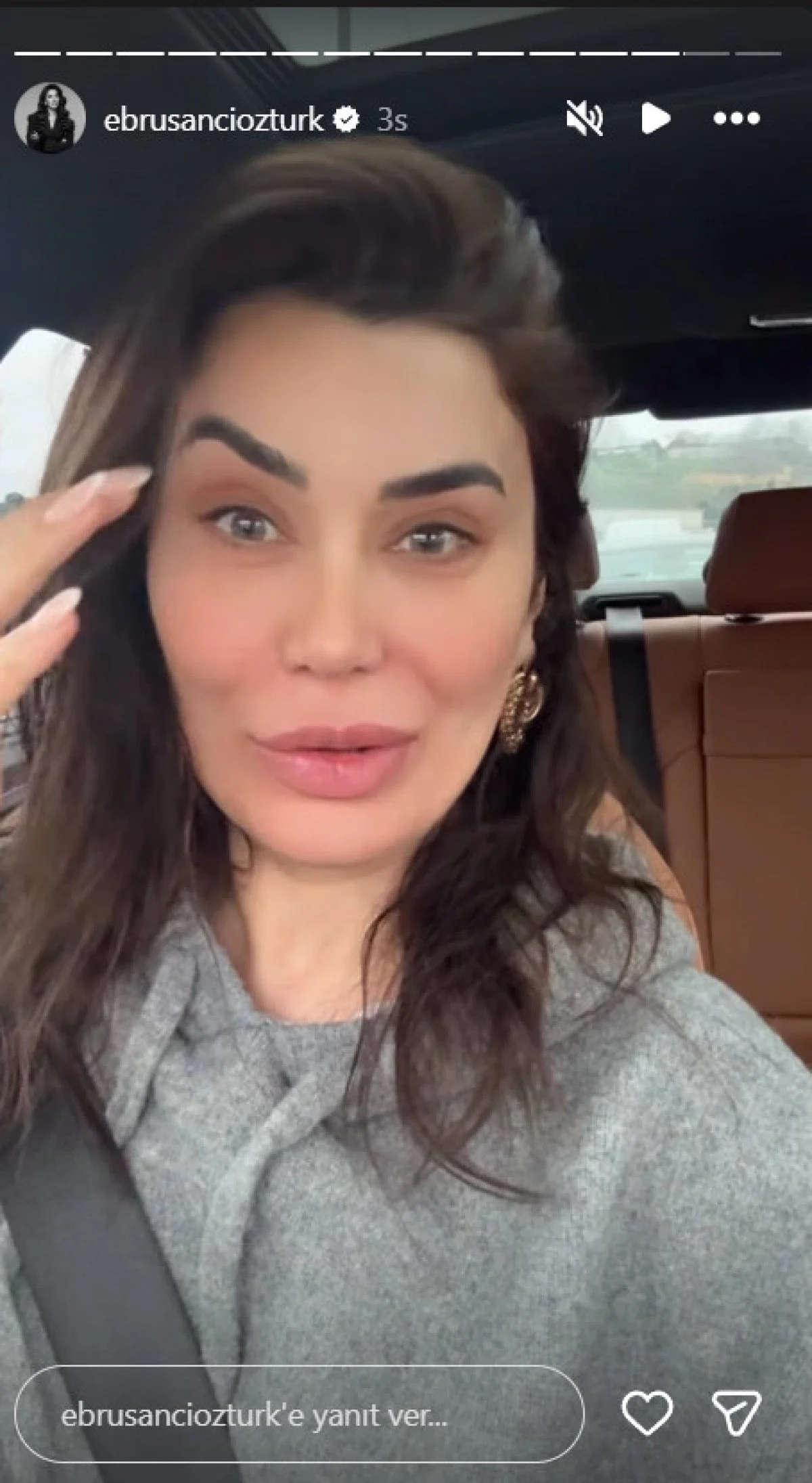 Botoks Yaptıran Ebru Şancı’nın Bir Kaşı Havada Kaldı