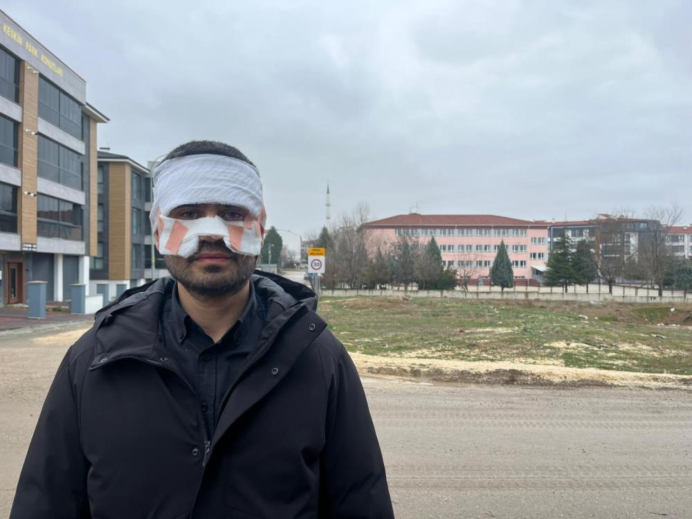 Öğretmen Meslektaşının Yüzüne Sıcak Çay Fırlattı