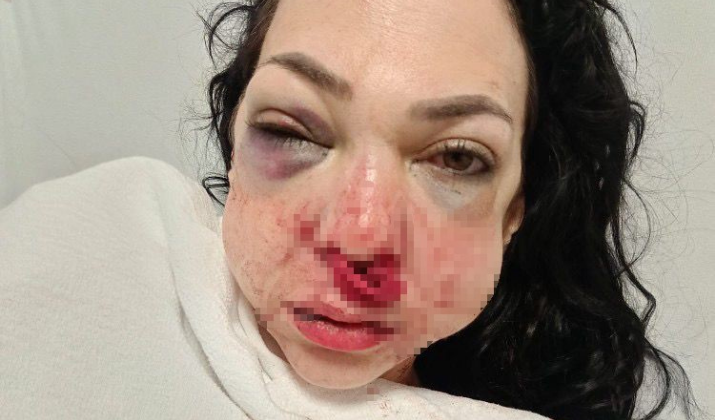 Oğlunun Gözü Önünde Anneyi Öldüresiye Dövdüler (1)