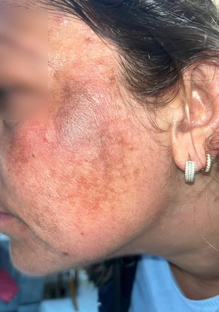 Güzeleşme Uğruna2