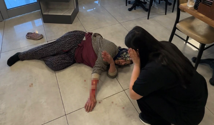 Ne Sandalye Ne Tekmeler Durduramadı Başıboş Köpek Kadının Kolunu Kopardı! (2)