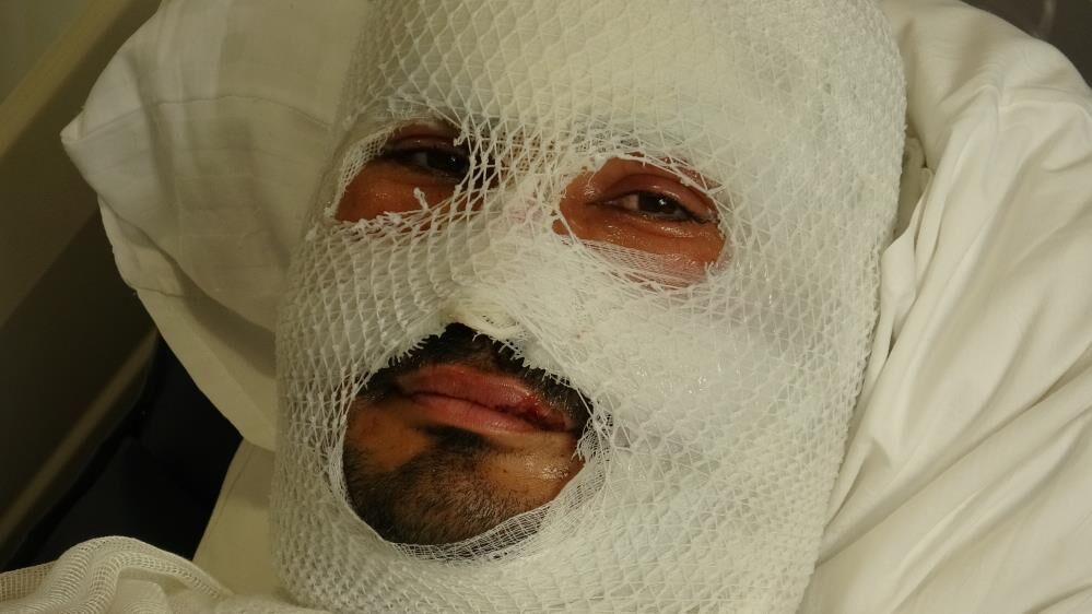 Patlamalarla Birlikte Alevlere Teslim Olan Evden Ailesini Kurtarmak Isterken Vücudu Ve Yüzü Yandı1