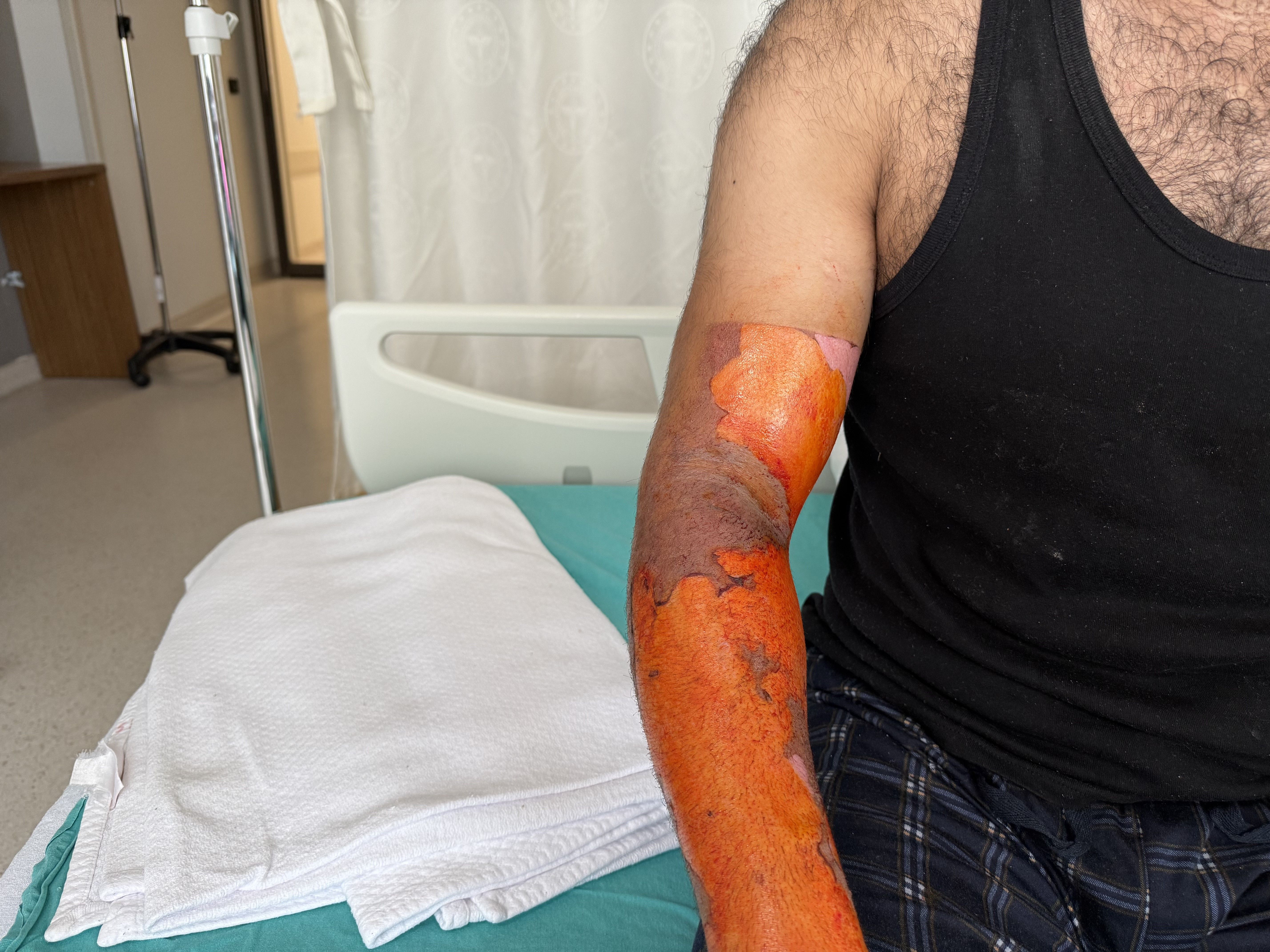 Aracın Aküsü Patladı, Alevlerin Arasında Kaldı! “Kendimi Zor Kurtardım” (1)